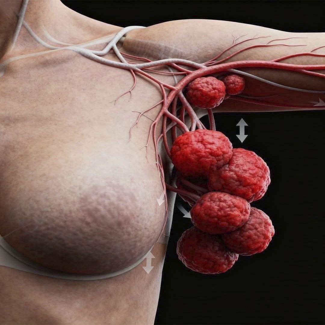 Estos son los síntomas que puedes padecer si tienes cáncer de mama