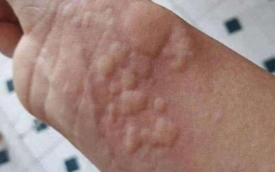 Estas son las consecuencias de acostarse con… Ver másEstas son las consecuencias de acostarse con… Ver más