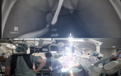 ¿Qué es la endometriosis y cuáles son sus síntomas?