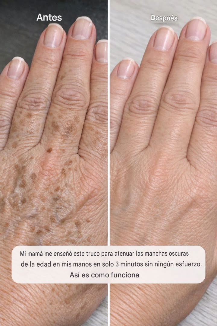 Mi madre me enseñó este truco para atenuar las manchas oscuras de la edad en mis manos en solo 3 minutos y sin ningún esfuerzo. Así es como funciona.