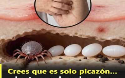 Alergia o Sarna: Cómo diferenciarlas y por qué no son lo mismo