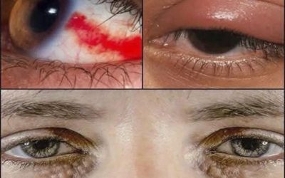 Señales en tus ojos que podrían estar revelando problemas de salud visual