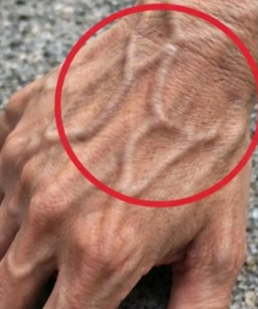 Si tienes venas visibles, significa que estás…