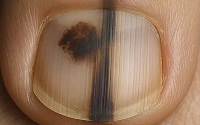 Transforma la Salud de Tus Uñas con un Remedio Natural