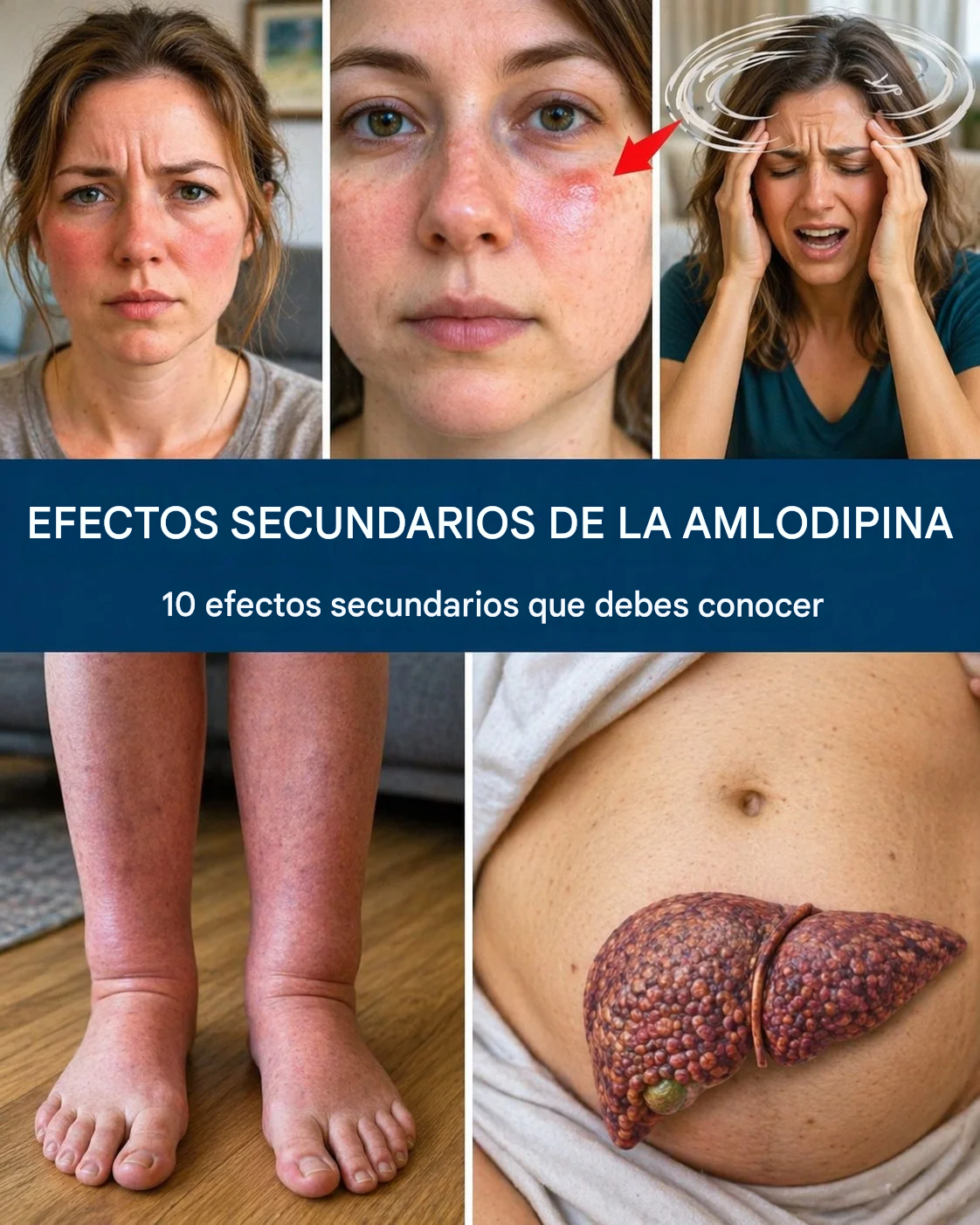¿Qué efectos secundarios de la amlodipina no se deben ignorar hoy?