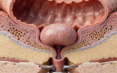 Así empieza el cáncer de colon: las señales silenciosas que muchos ignoran