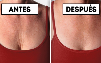 Arrugas del escote: 5 consejos para prevenirlas y eliminarlas