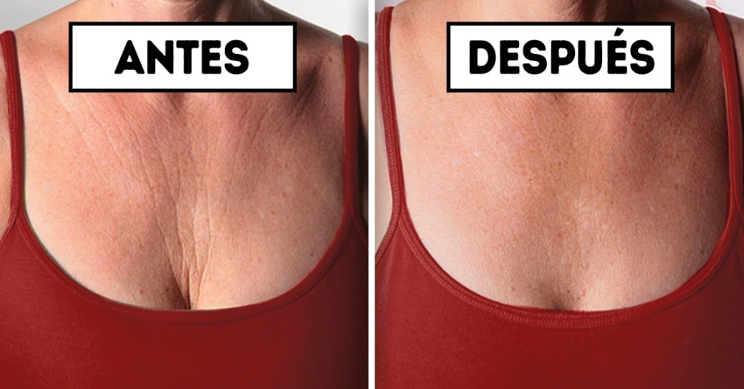Arrugas del escote: 5 consejos para prevenirlas y eliminarlas