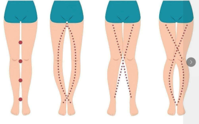 Las piernas de una mujer pueden revelar cómo está… Ver más