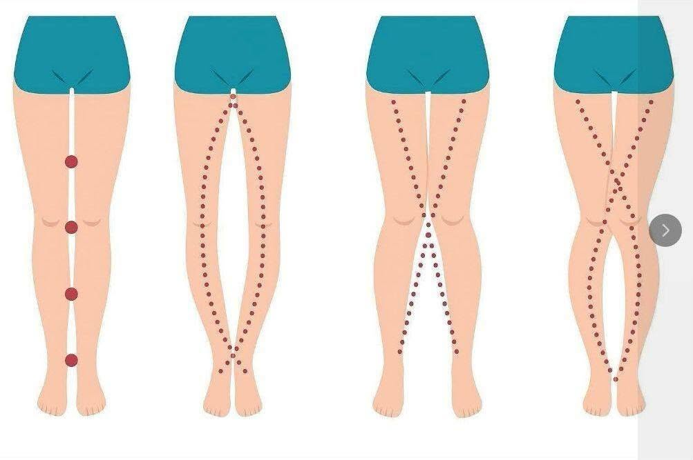 Las piernas de una mujer pueden revelar cómo está… Ver más