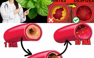 Di adiós a las arterias obstruidas, con estos poderosos alimentos (¡mejores que la aspirina!) Para seguir recibiendo mis recetas, solo debes decir algo… ¡Gracias!