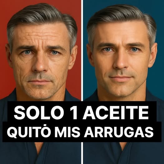 YO MISMA LA HICE Y NADIE LO CREÍA, ESTA CREMA EN 8 DIAS ELIMINA TODAS LA ARRUGAS Y MANCHAS