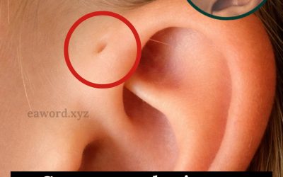 Las personas con este hoyo en la oreja tienen…Ver Mas