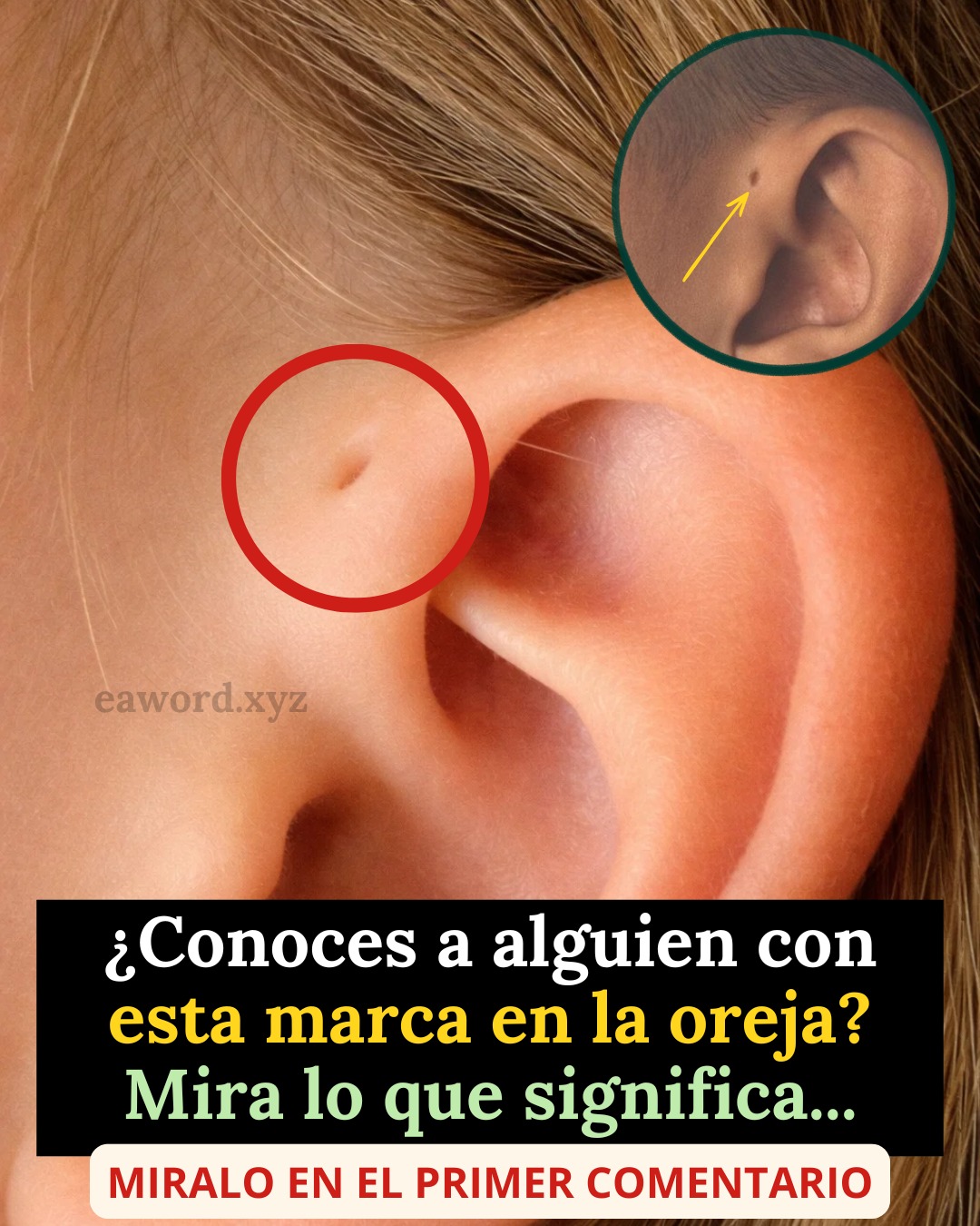 Las personas con este hoyo en la oreja tienen…Ver Mas
