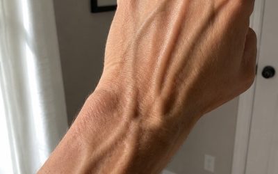 ¿Sabías que tener venas visibles significa que eres…? Ver más