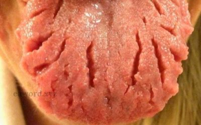 Si conoces a alguien que tiene la lengua así es por… Ver más