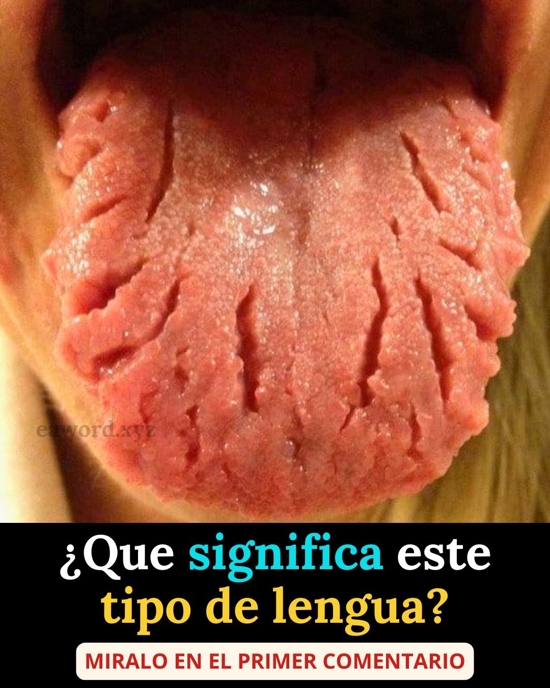 Si conoces a alguien que tiene la lengua así es por… Ver más
