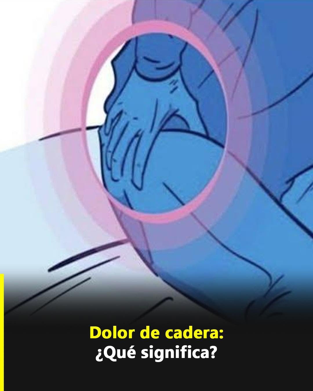 Dolor de cadera: qué significa y cuáles son sus posibles causas