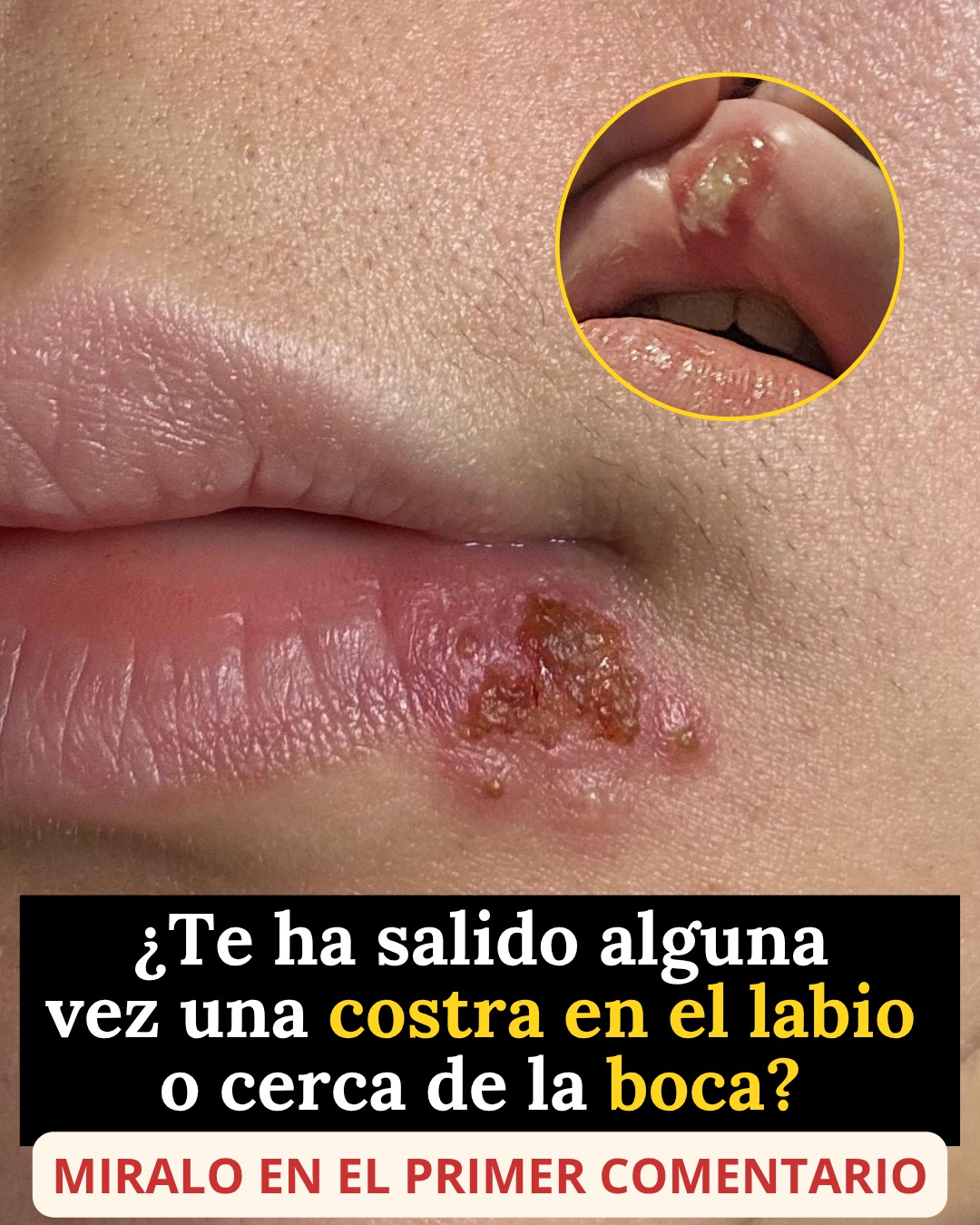 Estas se contagian cuando tienes se..Ver Mas