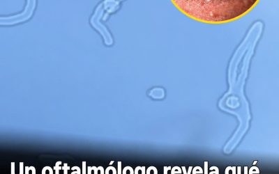 Moscas volantes en los ojos: qué son, por qué aparecen y cuándo consultar al oftalmólogo