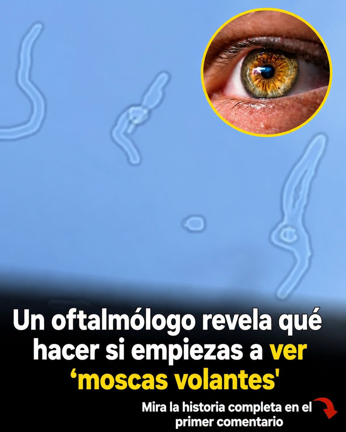Moscas volantes en los ojos: qué son, por qué aparecen y cuándo consultar al oftalmólogo