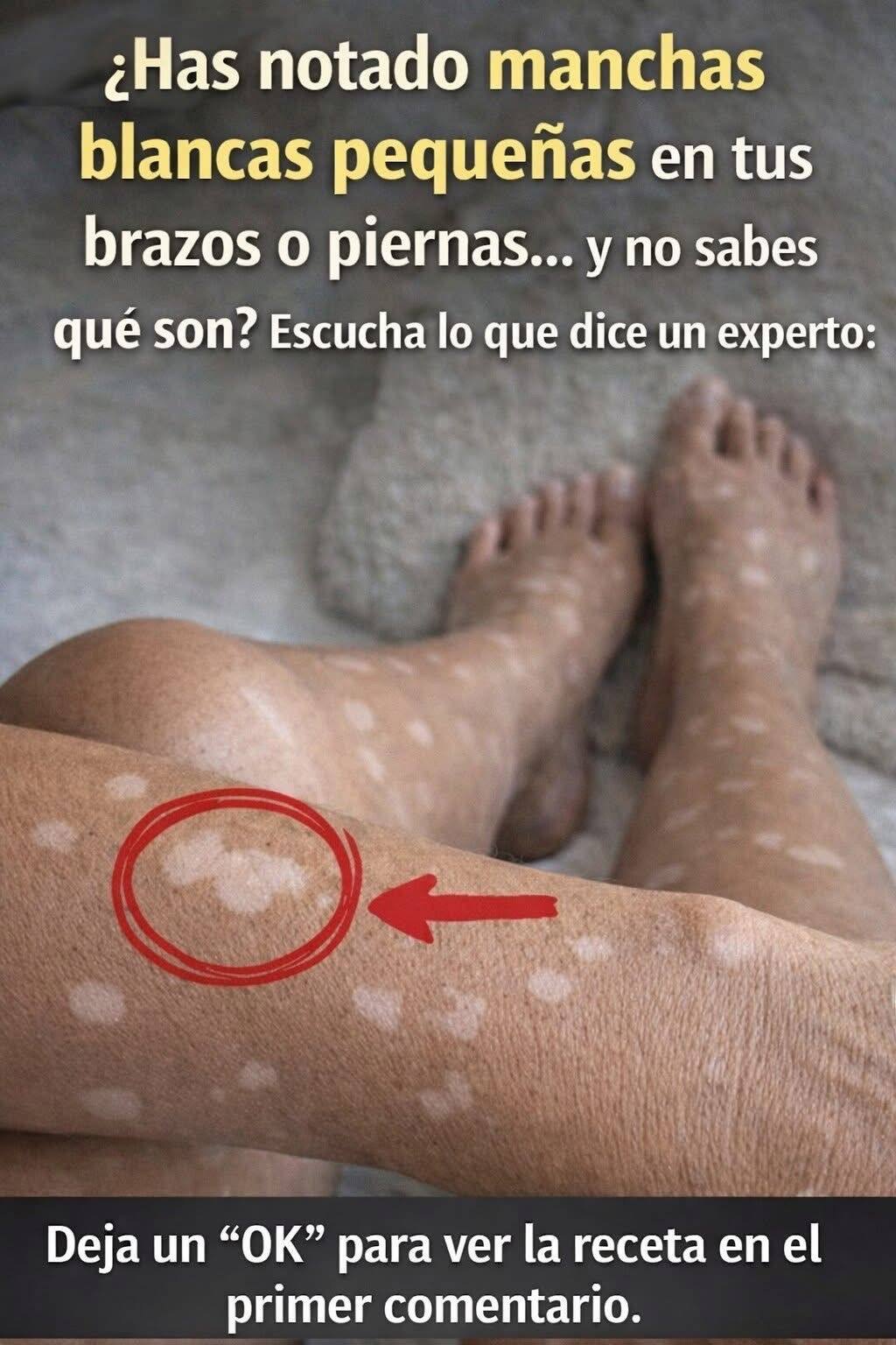 ¿Por qué aparecen manchas blancas en las uñas?