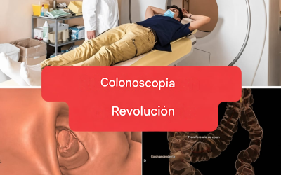 Nuevo método: la colonoscopia ya no será un examen invasivo. (1/2)